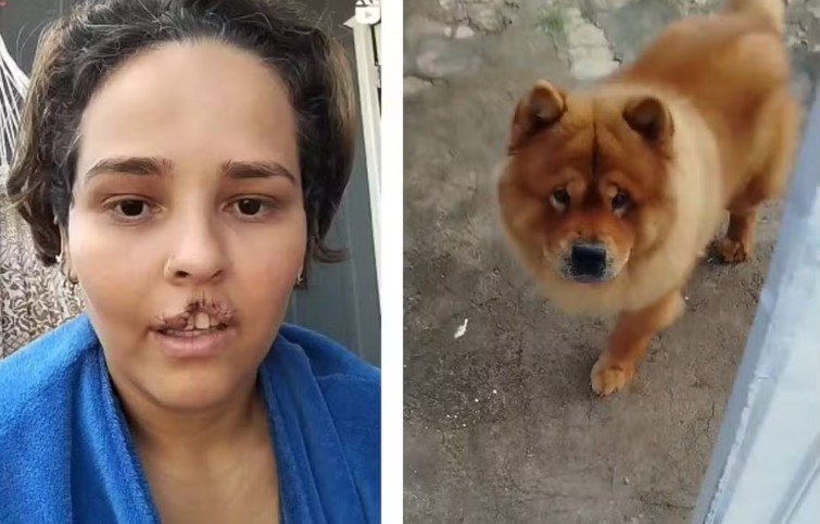 Cão é sacrificado após arrancar parte do lábio da tutora em Ji-Paraná