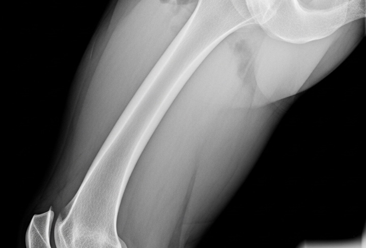 Unimed é condenada por erro médico e falha em perícia em Manaus