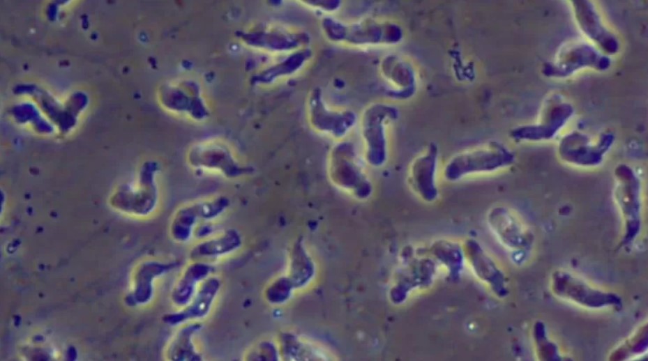 Idosa morre após contrair ameba comedora de cérebros durante lavagem nasal
