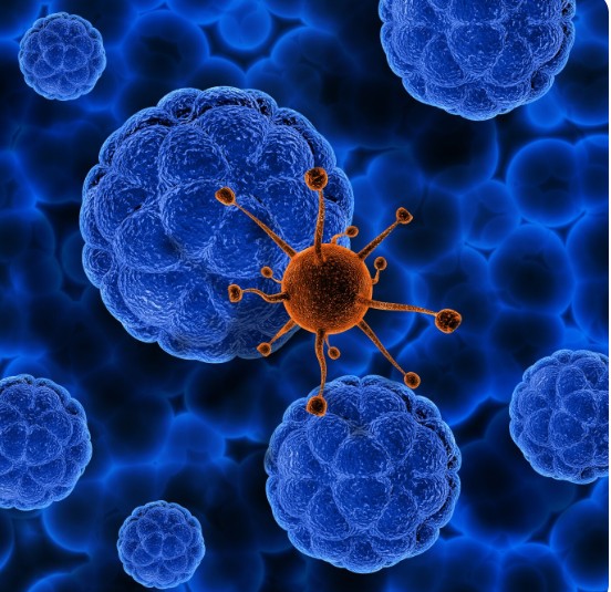 Brasil aposta no BRICS para ampliar acesso à terapia CAR-T contra o câncer