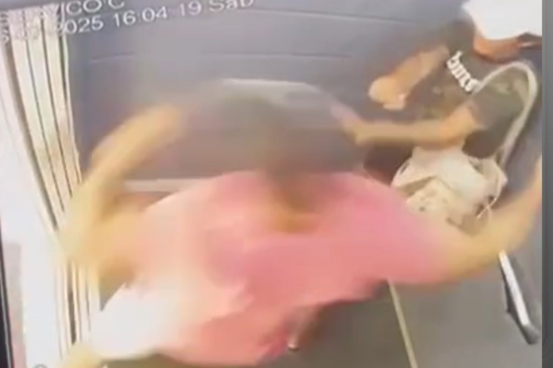 Mulher tem rosto desfigurado após ser espancada com 60 socos do namorado em Natal