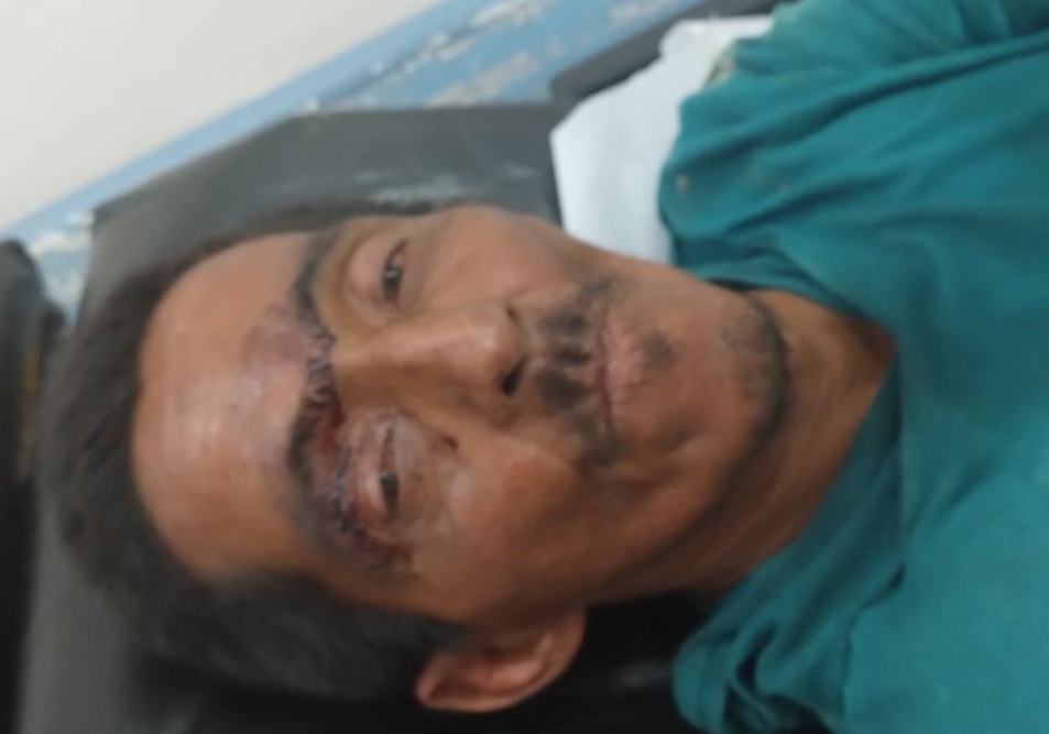 Hospital João Lúcio busca por família de paciente sem comunicação