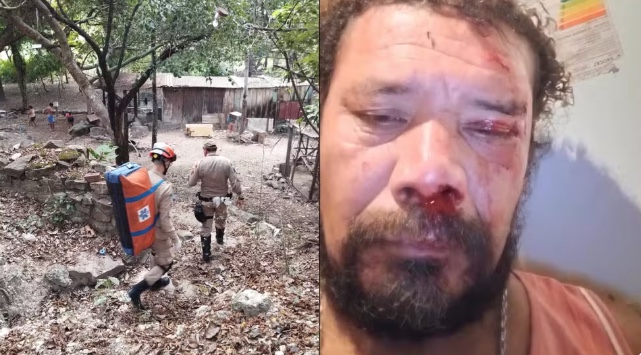 Homem é atacado por onça ao tentar defender seus cachorros