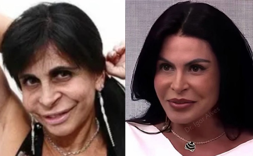 Gretchen surge com novo visual e rebate críticas