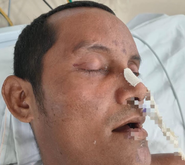 Hospital de Manaus busca identificação de paciente ferido após queda