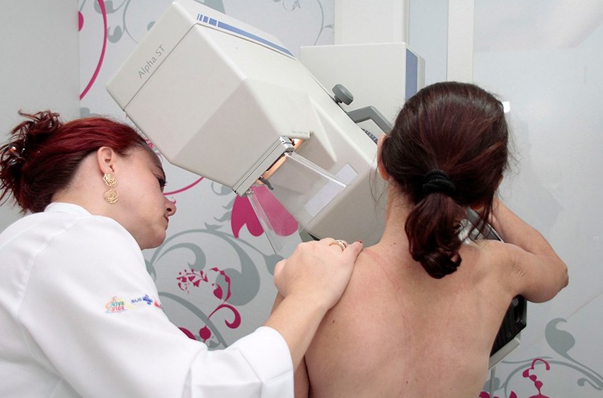 Lula sanciona lei que garante mamografia pelo SUS para mulheres a partir dos 40 anos