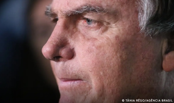 Bolsonaro tem nova crise de soluços e passa por terceira cirurgia