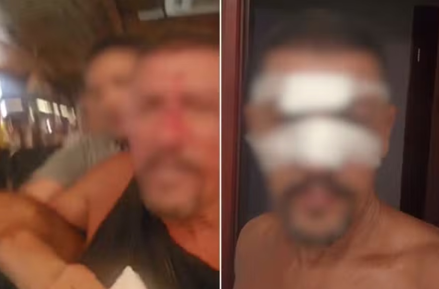 Empresário é agredido por segurança de quiosque após perder comanda em SP