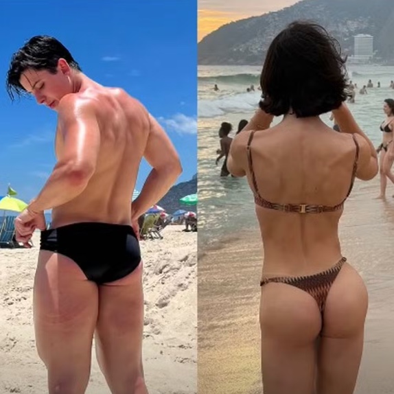 Bella Longuinho exibe antes e depois de procedimento nos glúteos; veja