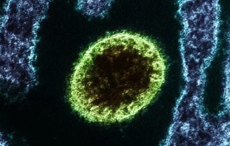 Índia registra surto de vírus letal e coloca autoridades de saúde em alerta