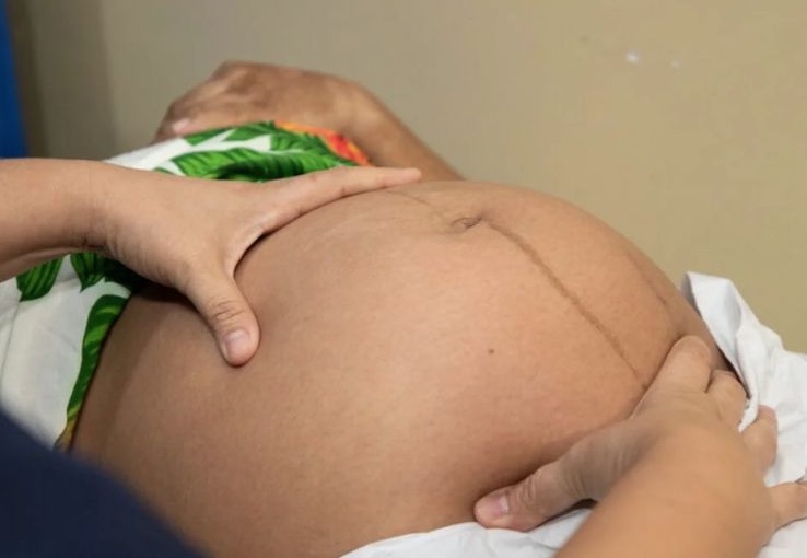 MPF cobra que violência obstétrica vire infração ética no Amazonas