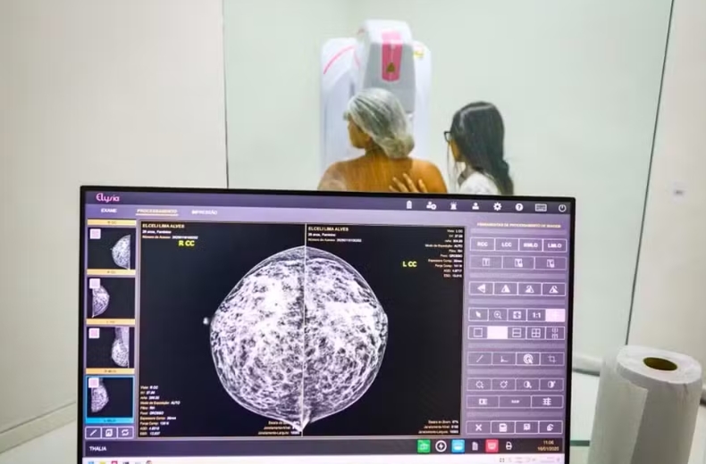 Ministério da Saúde passa a recomendar mamografia a partir dos 40 anos