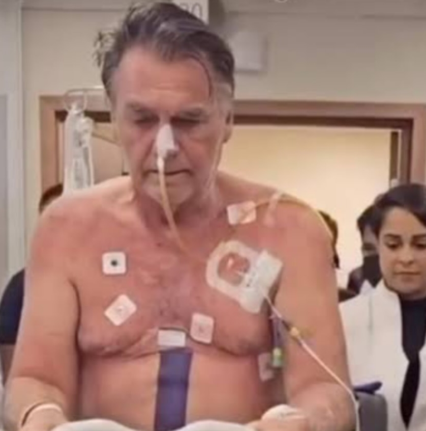 Bolsonaro inicia fisioterapia após cirurgia e apresenta evolução positiva