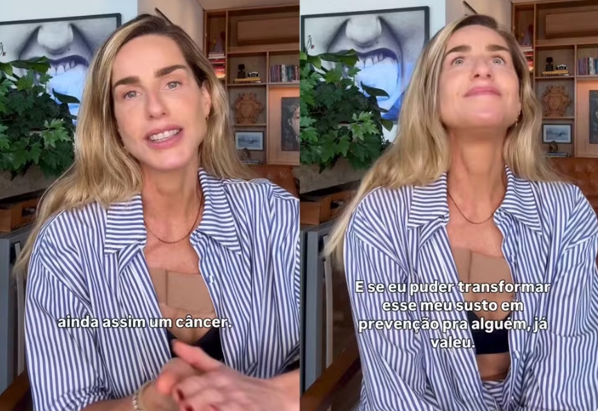 Modelo Mariana Weickert anuncia diagnóstico de câncer de pele e faz alerta