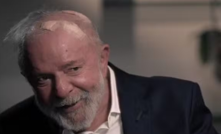 Lula passa por novos exames em Brasília e apresenta melhora