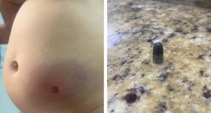 Bebê de 11 meses é atingida por bala perdida dentro de casa