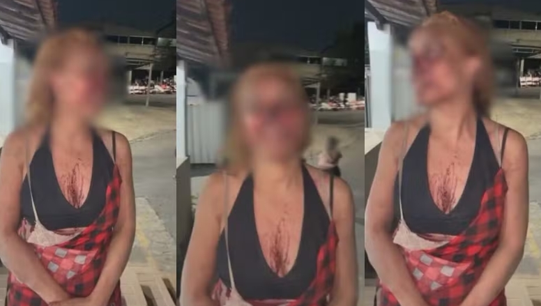 Advogada é espancada com pá de ferro e vassoura por discussão sobre lixo