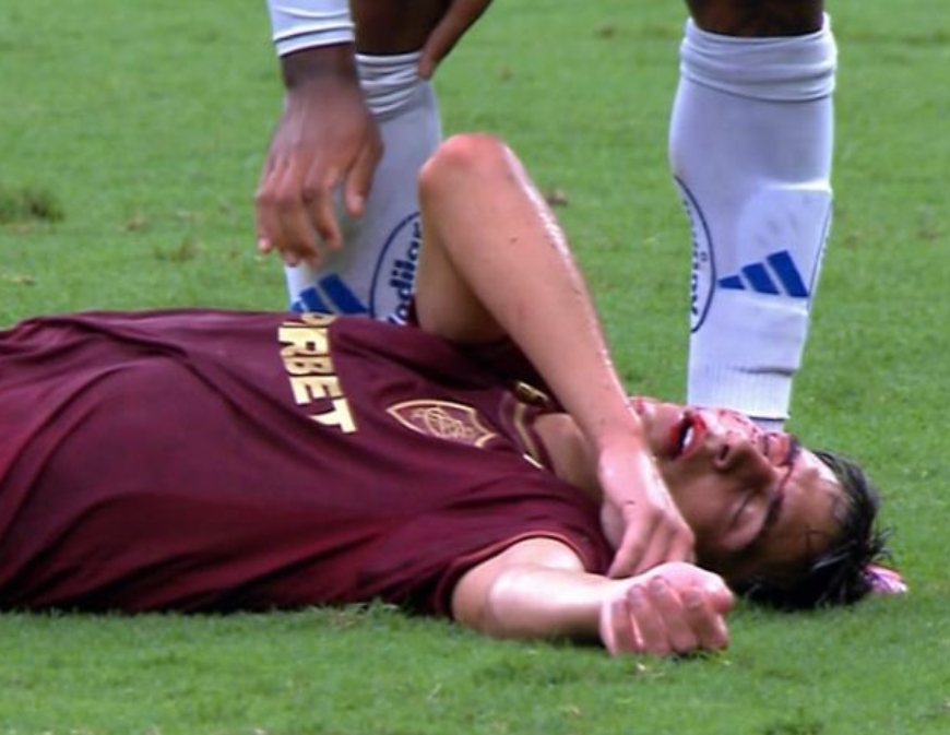 Cruzeiro e Fluminense empatam com acidente e polêmica de arbitragem