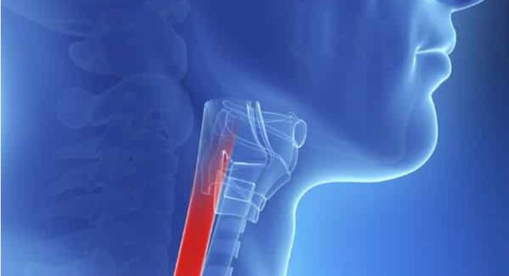 Estudo investiga como começa e evolui o câncer de esôfago