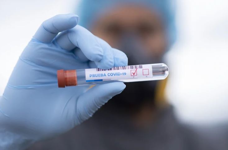 Amazonas registra 62 novos casos de Covid em 24 horas