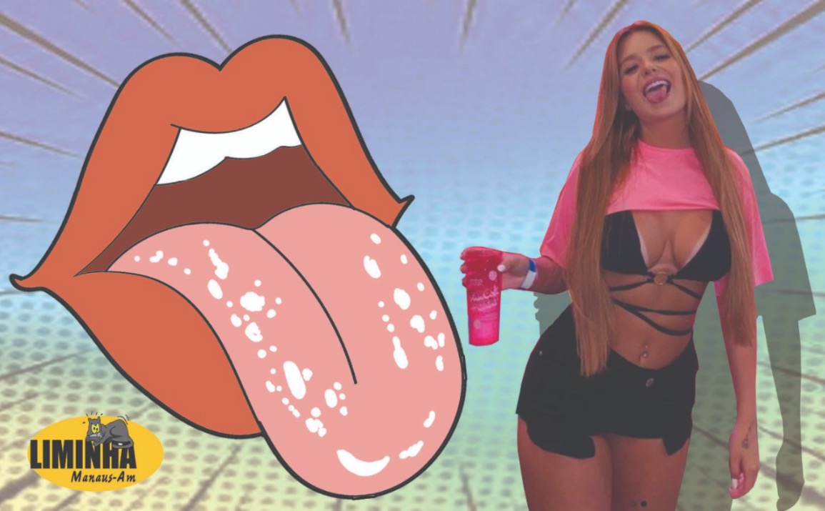 Viih Tube beija 46 em festa e diz que não pegou 'sapinho'; conheça a doença