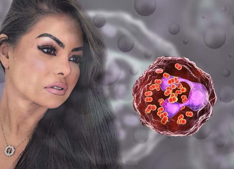Meningite: como se pega a doença que atingiu cérebro de Paulinha Abelha?