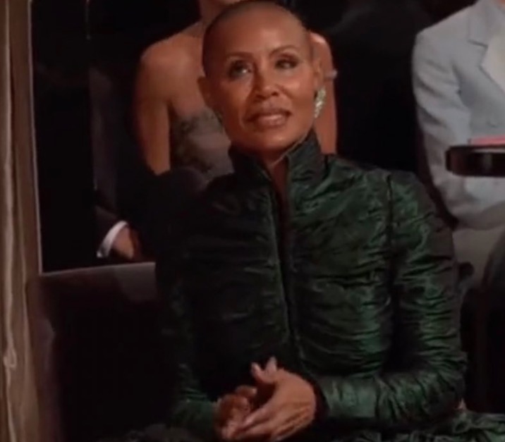 Entenda o que é alopécia, condição da esposa de Will Smith