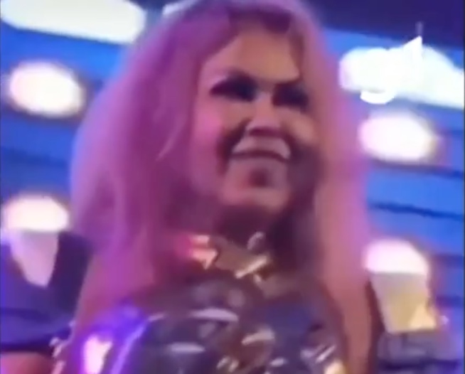 Sequelas da Covid podem causar inchaço? Entenda o caso de Joelma