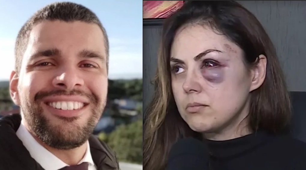 Homem que espancou procuradora vira réu por tentativa de feminicídio