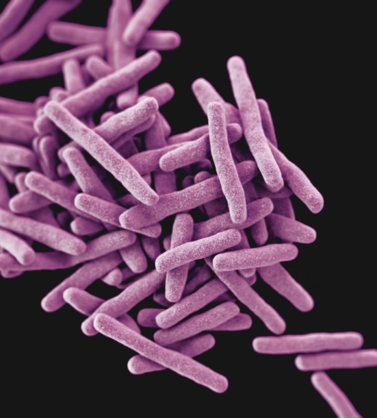 Tosse com mais de 2 semanas pode ser tuberculose; conheça os sintomas