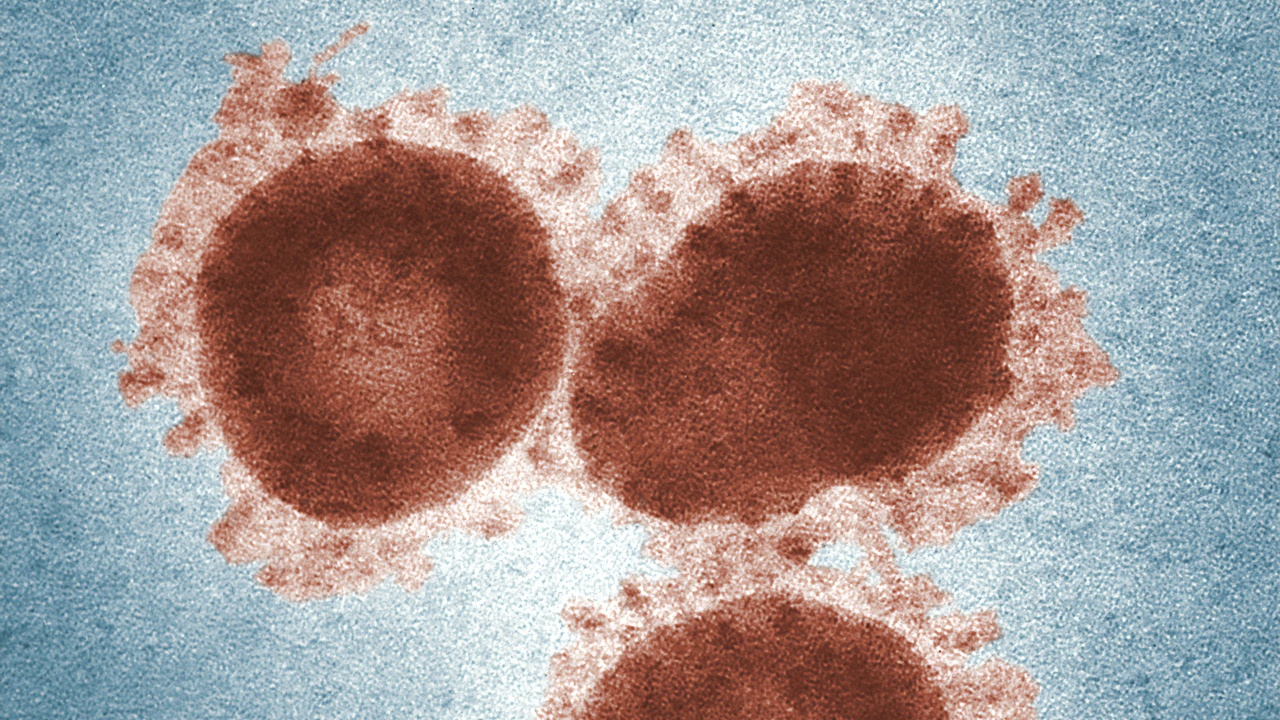 Rio de Janeiro investiga caso suspeito de varíola dos macacos