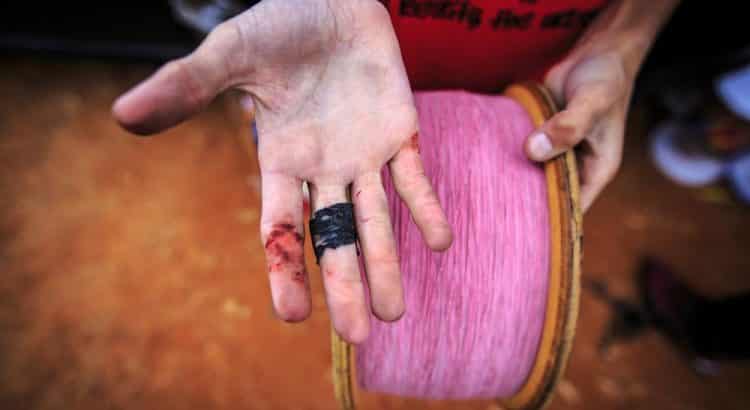 Motociclista morre após ter pescoço cortado por linha com cerol