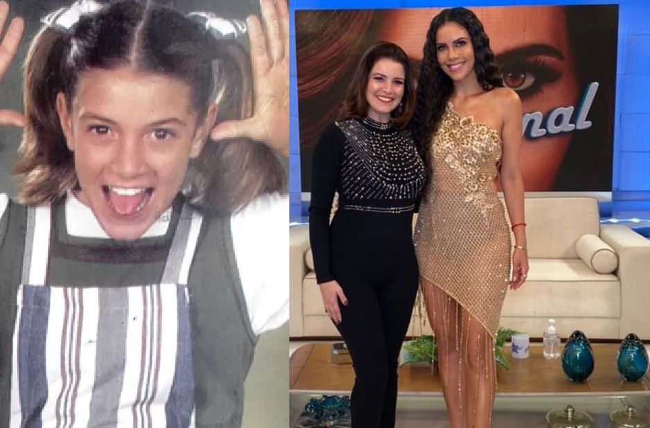 Após botox, ex-Chiquitita perde movimento do olho temporariamente 