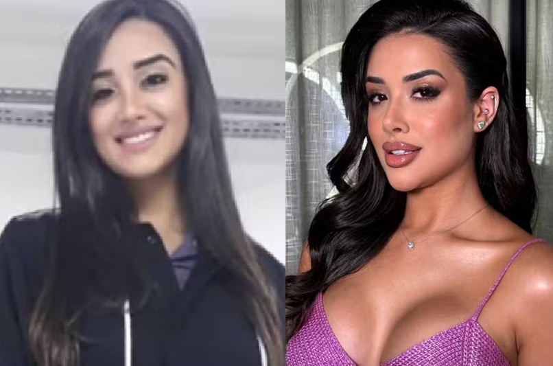 Candidata da Casa de Vidro investiu R$ 40 mil em plásticas antes do BBB26