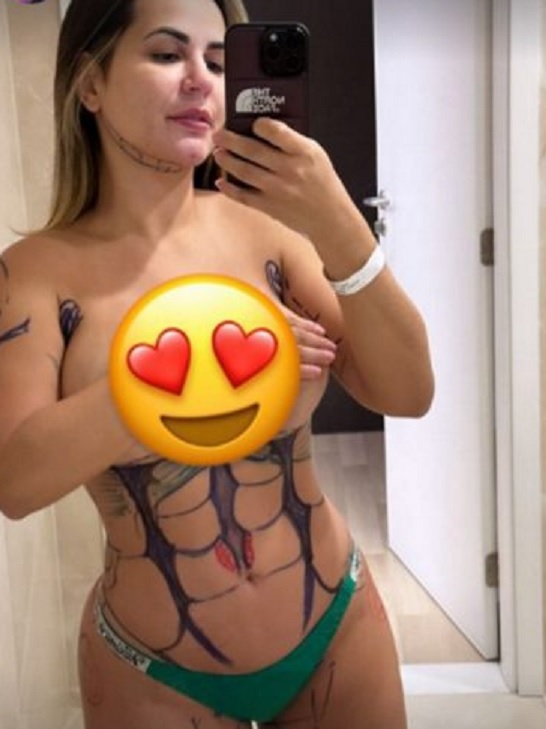 Deolane Bezerra se submete a lipoaspiração HD: ‘ficar gostosa’