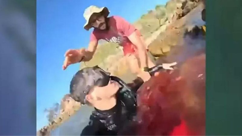 Jovem perde perna em ataque de tubarão e se filma sangrando: 'Me despedir'