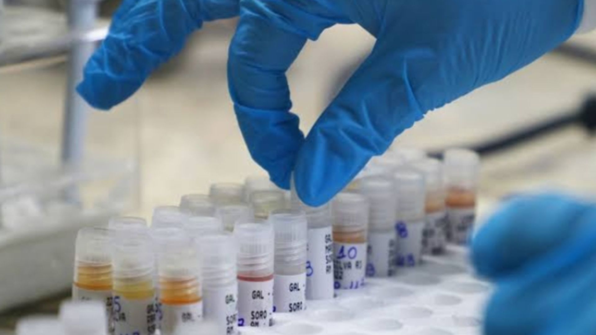 Brasil contabiliza 1,5 mil casos de mpox em 2024