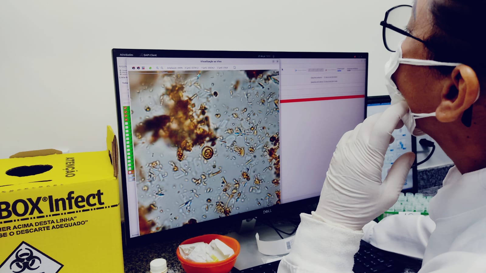 Manaus inaugura novo laboratório automatizado de diagnóstico de parasitas