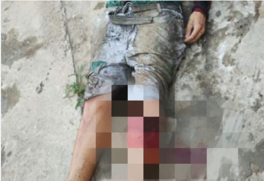 Homem tem perna dilacerada durante tiroteio no Santo Agostinho