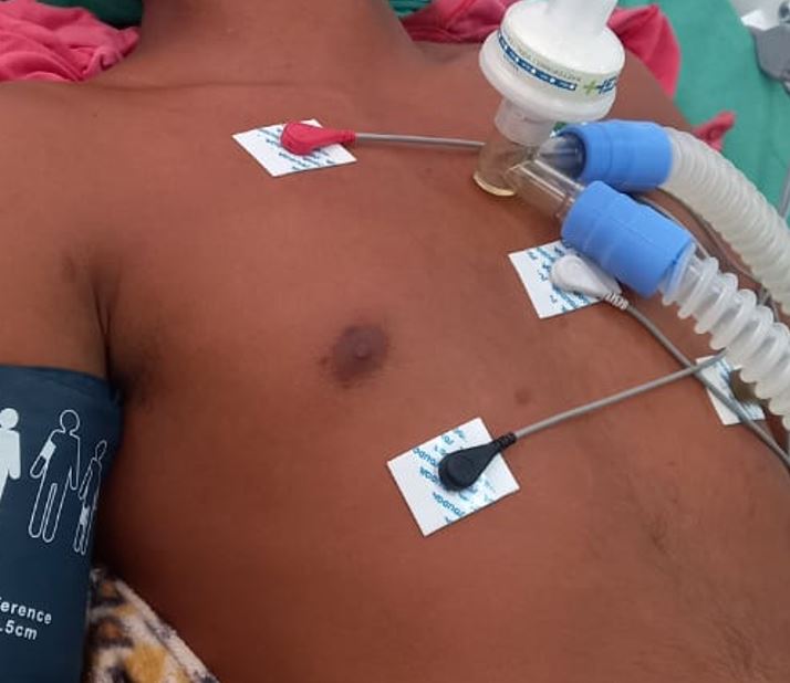 Confusão em bar termina com jovem morto a golpes de cacetete no Amazonas