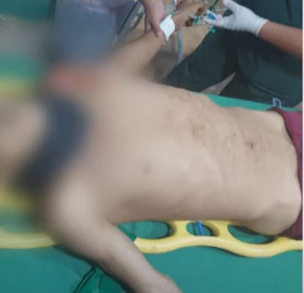 Jovem é baleado no peito ao tentar roubar barco de delegacia no Amazonas