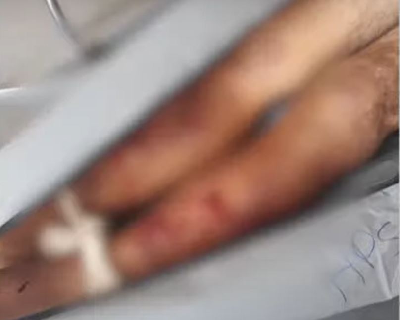 Idoso suspeito de estuprar criança morre após ser espancado em Manaus