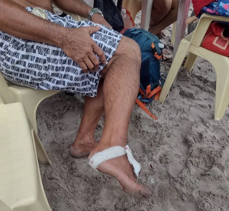 Banhistas são atacados por piranhas dentro de balneário em Manaus