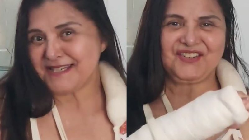 Atriz Elizangela sofre acidente doméstico e fratura os dois braços 