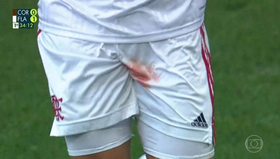 Gustavo Henrique tem testículo rasgado e deixa jogo do Flamengo sangrando