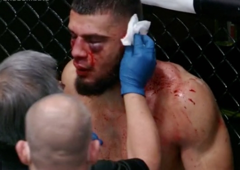 Ramiz Brahimaj fica com orelha pendurada após levar golpe brutal no UFC