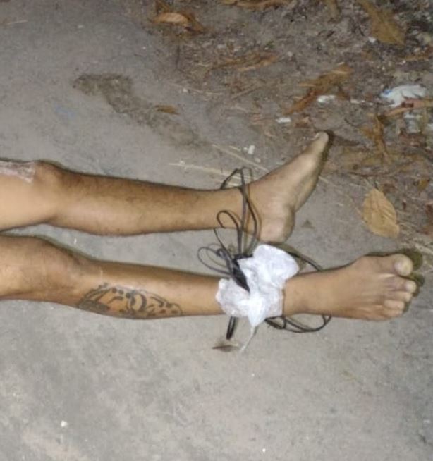 Com mãos e pés amarrados, homem é achado morto em rua do Tarumã