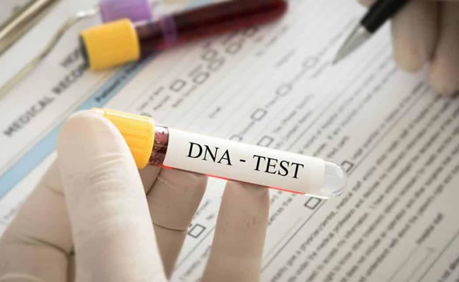 Jovem será indenizada por laboratório após erro em exame de DNA