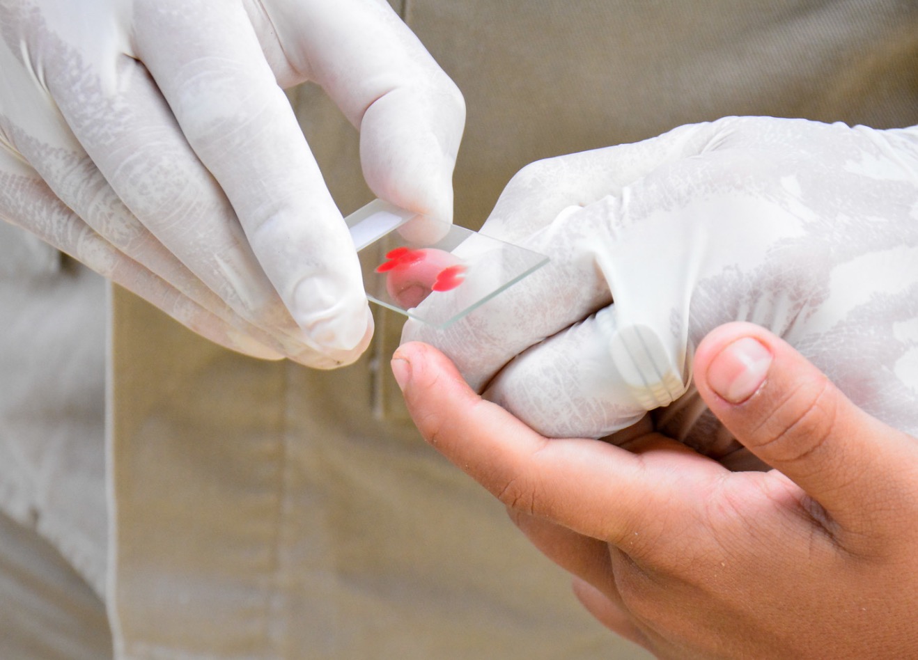 Manaus reduz em 50,3% casos de malária nos primeiros 4 meses do ano