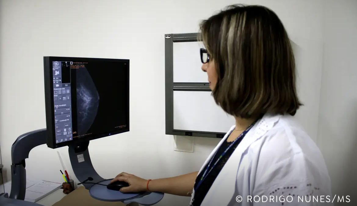 ANS estuda ampliar faixa etária para mamografia 